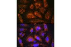 Immunofluorescence analysis of U-2 OS cells using Laminin beta 1 Rabbit mAb (ABIN7268185) at dilution of 1:100 (40x lens).