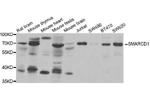Western blot analysis of extracts of various cell lines, using SMARCD1 antibody. (SMARCD1 anticorps  (AA 216-515))