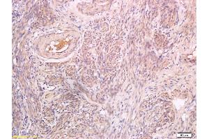 anti-Pro-Inhibin beta B (AA 251-350) antibody