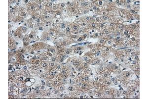 Immunohistochemical staining of paraffin-embedded Human liver tissue using anti-C9orf41 mouse monoclonal antibody. (C9orf41 anticorps)
