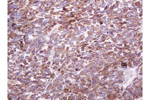Image no. 1 for anti-Mucin 1 (MUC1) antibody (ABIN1499598)