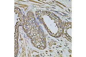 Immunohistochemistry of paraffin-embedded human prostate using CPOX antibody (ABIN5971997) at dilution of 1/100 (40x lens). (CPOX anticorps)