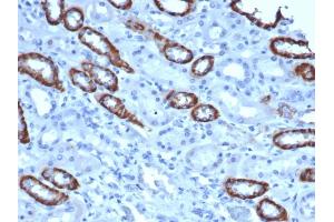 IHC analysis of formalin-fixed, paraffin-embedded human kidney. (TOM1L1 anticorps)