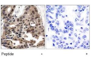 Image no. 1 for anti-Eukaryotic Translation Initiation Factor 4E Binding Protein 1 (EIF4EBP1) (Thr36) antibody (ABIN197450)