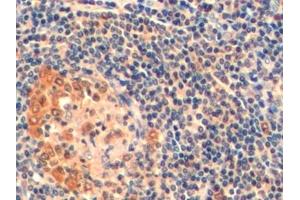 Detection of TYMS in Human Tonsil Tissue using Polyclonal Antibody to Thymidylate Synthetase (TYMS)