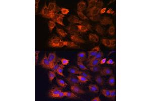 Immunofluorescence analysis of C6 cells using RPS8 antibody (ABIN7270041) at dilution of 1:100.