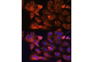 Immunofluorescence analysis of C6 cells using RPS8 antibody (ABIN7270041) at dilution of 1:100. (RPS8 anticorps)