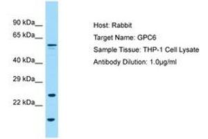 Image no. 1 for anti-Glypican 6 (GPC6) (AA 36-85) antibody (ABIN6749994) (Glypican 6 anticorps  (AA 36-85))