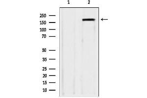 Western blot analysis of lysates from various samples, using ZCCHC11 antibody.