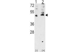 Western Blotting (WB) image for anti-Vascular Endothelial Growth Factor C (VEGFC) antibody (ABIN3001426) (VEGFC anticorps)