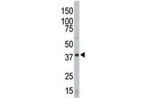 Western blot analysis of CDK4 antibody and HL-60 cell lysate