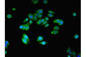 Immunofluorescent analysis of HepG2 cells using ABIN7161035 at dilution of 1:100 and Alexa Fluor 488-congugated AffiniPure Goat Anti-Rabbit IgG(H+L) (NANOS2 anticorps  (AA 1-138))