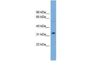 WB Suggested Anti-PHF13 Antibody Titration:  0. (PHF13 anticorps  (Middle Region))