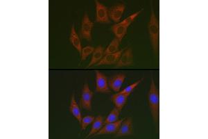 Immunofluorescence analysis of NIH/3T3 cells using Lumican (LUM) Rabbit pAb (ABIN6128190, ABIN6143388, ABIN6143389 and ABIN6220988) at dilution of 1:100 (40x lens).