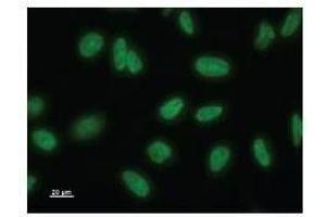 Immunostaining analysis in HeLa cells.