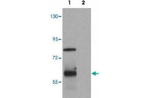 Western blot analysis of TSN in rat lung tissue lysate with TSN polyclonal antibody  at (1) 0.