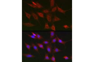Immunofluorescence analysis of NIH/3T3 cells using RIPK1/RIP Rabbit pAb (ABIN6132596, ABIN6146959, ABIN6146960 and ABIN6223282) at dilution of 1:150 (40x lens). (RIPK1 anticorps  (AA 170-440))