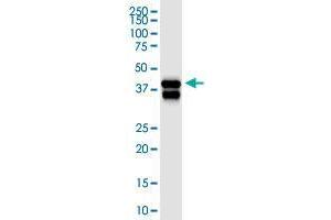 SERPINB5 monoclonal antibody (M01), clone 1F7.