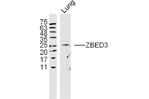 Rat lung lysates probed with ZBED3 Polyclonal Antibody, Unconjugated  at 1:300 dilution and 4˚C overnight incubation. (ZBED3 anticorps  (AA 51-150))