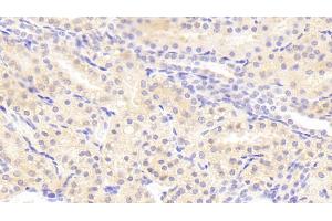 Detection of GRM1 in Human Kidney Tissue using Polyclonal Antibody to Glutamate Receptor, Metabotropic 1 (GRM1)