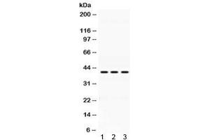 Western blot testing of 1) rat lung, 2) mouse liver and 3) human HepG2 lysate with Alcohol dehydrogenase antibody at 0. (ADH1A anticorps)
