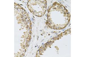 Immunohistochemistry of paraffin-embedded human prostate using POP4 antibody (ABIN5972510) at dilution of 1/100 (40x lens). (RPP29 anticorps)