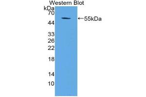 Western blot analysis of the recombinant protein. (AATF anticorps  (AA 240-438))