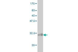 Western Blot detection against Immunogen (33.