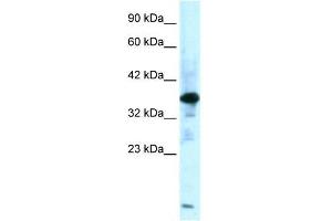 Human Muscle; WB Suggested Anti-ZFPL1 Antibody Titration: 0. (ZFPL1 anticorps  (Middle Region))