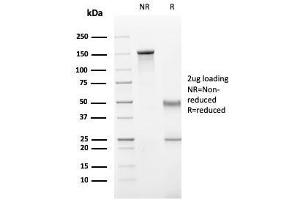 SDS-PAGE Analysis Purified CD11b Monospecific Mouse Monoclonal Antibody (ITGAM/3340).