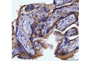 IHC analysis of ITGAV using anti-ITGAV antibody (ABIN7602396).