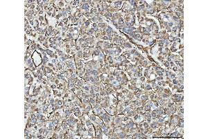 IHC analysis of PTRF/CAVIN1 using anti-PTRF/CAVIN1 antibody (ABIN7601817). (PTRF anticorps  (AA 47-390))