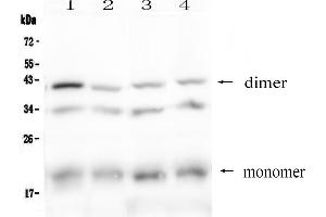 Western blot analysis of BAFF Receptor using anti-BAFF Receptor antibody .