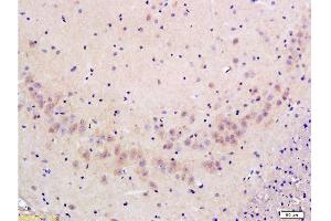 Formalin-fixed and paraffin embedded: rat brain tissue labeled with Anti-FLIP/c FLIP Polyclonal Antibody , Unconjugated at 1:300 followed by conjugation to the secondary antibody and DAB staining (FLIP anticorps  (AA 7-100))