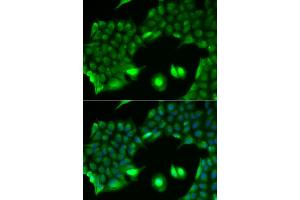 Immunofluorescence analysis of HeLa cells using SSX2 antibody. (SSX2 anticorps)