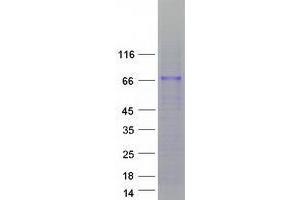 Validation with Western Blot