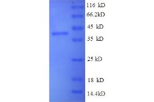 SDS-PAGE (SDS) image for Brain-Derived Neurotrophic Factor (BDNF) (AA 137-237), (partial) protein (GST tag) (ABIN5712421)
