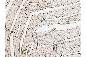 IHC analysis of PPCS using anti-PPCS antibody (ABIN7602752). (PPCS anticorps  (C-Term))