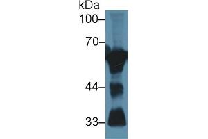 Detection of CaN in Mouse Cerebrum lysate using Polyclonal Antibody to Calcineurin (CaN)
