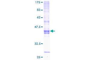 Image no. 1 for Inducible T-Cell Co-Stimulator (ICOS) (AA 1-168) protein (GST tag) (ABIN1307339)
