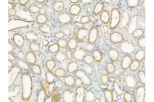 ABIN6264177 and ABIN6273064 at 1/100 staining human normal kidney tissue by IHC-P. (PHGDH anticorps  (N-Term))