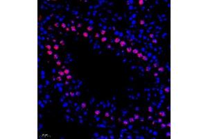 Immunofluorescence of paraffin embedded mouse testis using DNApoldelta3 (ABIN7075130) at dilution of 1:650 (400x lens)