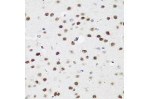 Immunohistochemistry of paraffin-embedded mouse brain using  antibody (ABIN6131366, ABIN6136608, ABIN6136609 and ABIN6223268) at dilution of 1:200 (40x lens). (AEBP2 anticorps  (AA 234-503))