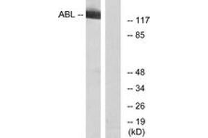 Western blot analysis of extracts from RAW264. (ABL1 anticorps  (AA 406-455))