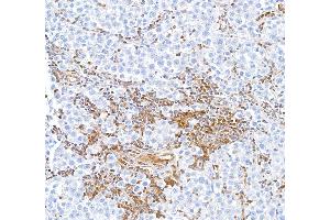 Immunohistochemistry (IHC) image for anti-Signal Transducer and Activator of Transcription 5A (STAT5A) (AA 744-794) antibody (ABIN7454017) (Recombinant STAT5A anticorps  (AA 744-794))