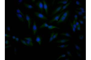 Immunofluorescence staining of Hela Cells with ABIN7127809 at 1:50, counter-stained with DAPI. (Recombinant SIRT1 anticorps)