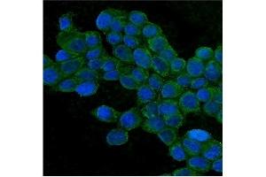 IF analysis of TJP1 using anti-TJP1 antibody (ABIN7599787).
