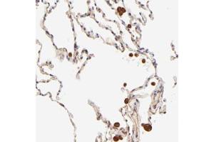 Immunohistochemical staining of human lung with TNFAIP3 polyclonal antibody  shows strong cytoplasmic positivity in macrophages. (TNFAIP3 anticorps)