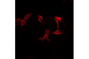 ABIN6274712 staining LOVO by IF/ICC. (AGPAT5 anticorps  (Internal Region))