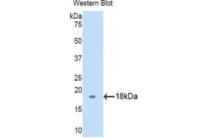 Western blot analysis of the recombinant protein. (Biglycan anticorps  (AA 49-182))